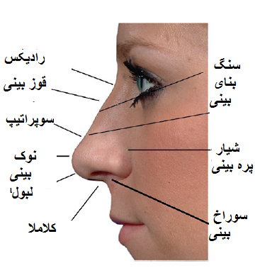 جراحی بینی 1
