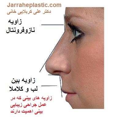 جراحی بینی 3