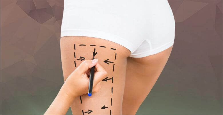  جراحی لیفت ران