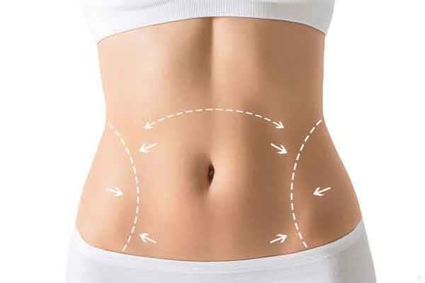 جراحی شکم یا ابدومینوپلاستی