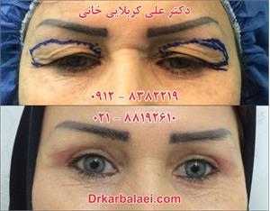 گالری پلک 4