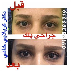 گالری پلک 2
