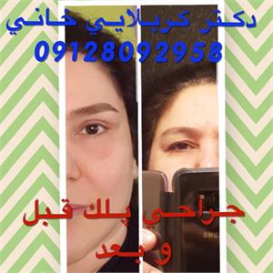 گالری پلک 1